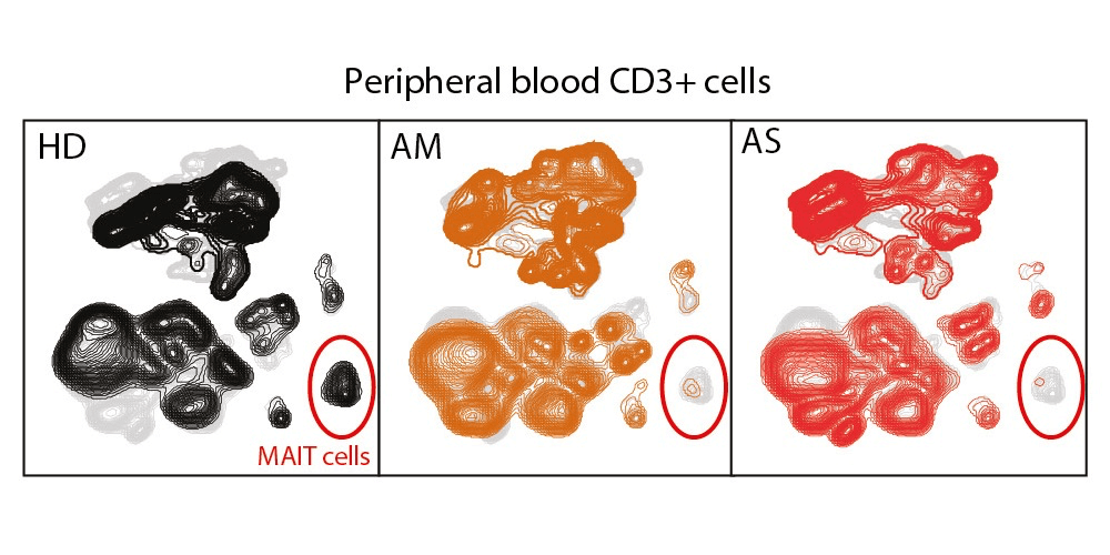 MAIT cell activation and dynamics studied in relation to COVID-19 disease severity