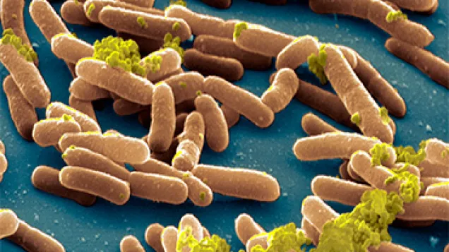 Outbreak of Salmonella Stanley in Sweden
